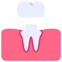 implantes dentales