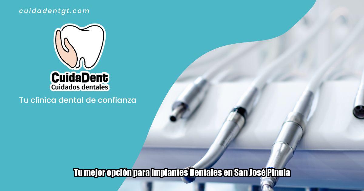Tu mejor opción para Implantes Dentales en San José Pinula