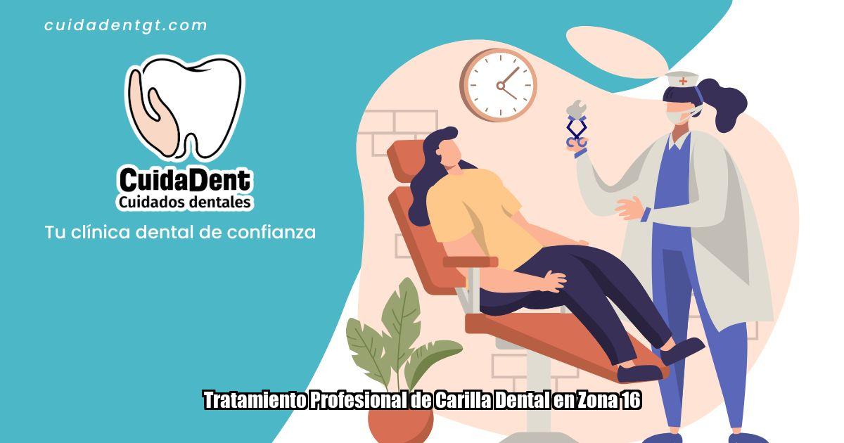 Tratamiento Profesional de Carilla Dental en Zona 16