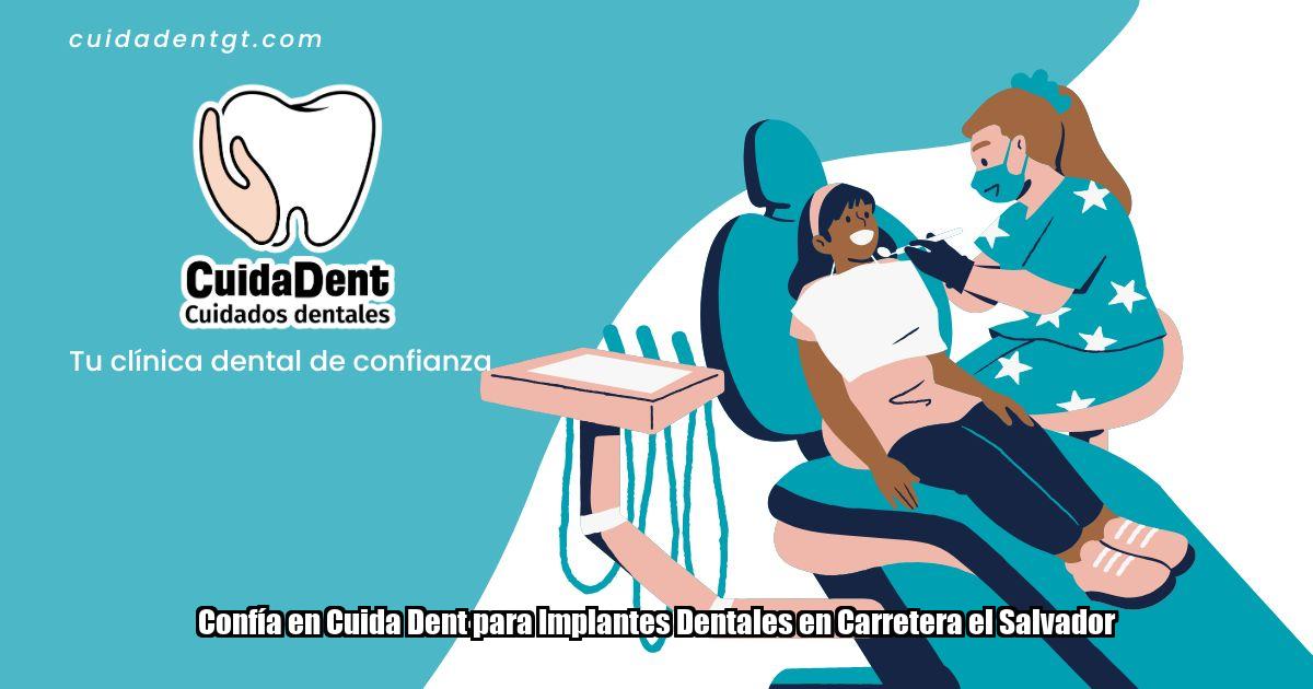 Confía en Cuida Dent para Implantes Dentales en Carretera el Salvador